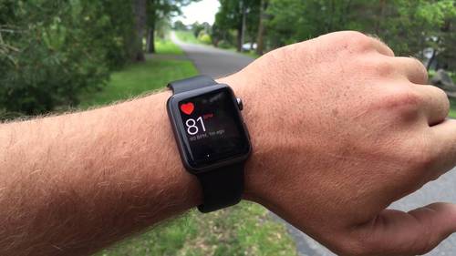 apple-watch-puls